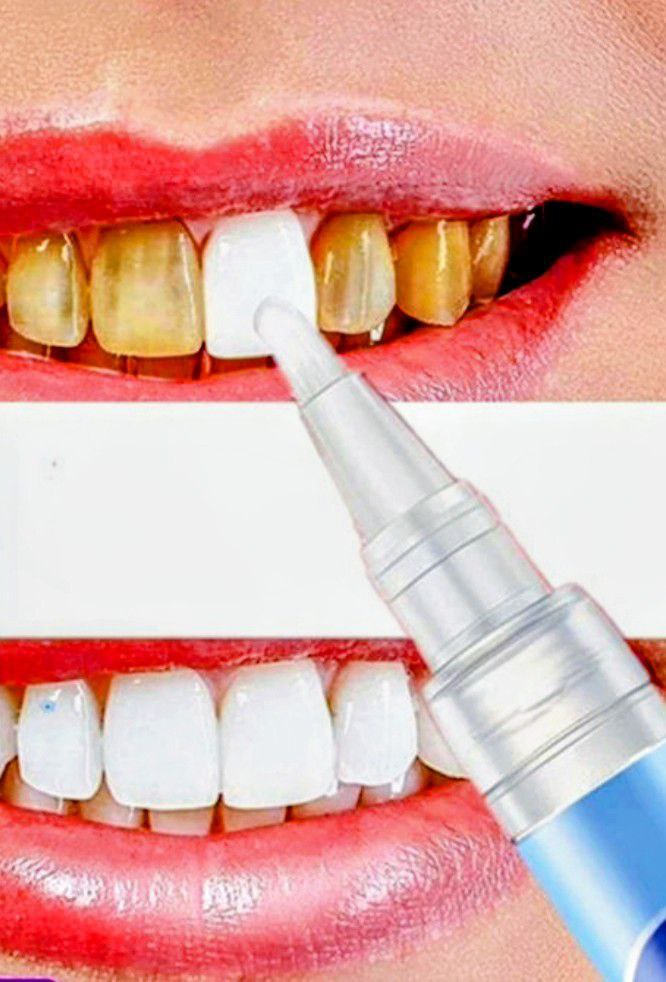 Retrouvez un Sourire Blanc et Confiant grâce à notre Stylo Dentaire Révolutionnaire !